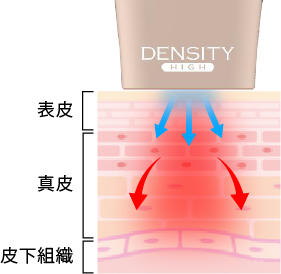 高出力のRF（高周波）エネルギーによる効果