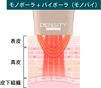 モノバイチップ