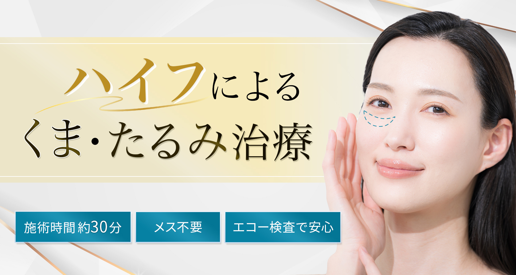 目の下のクマ取りハイフ