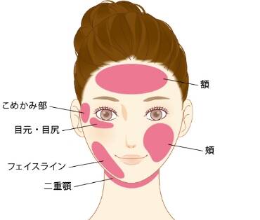 適応部位