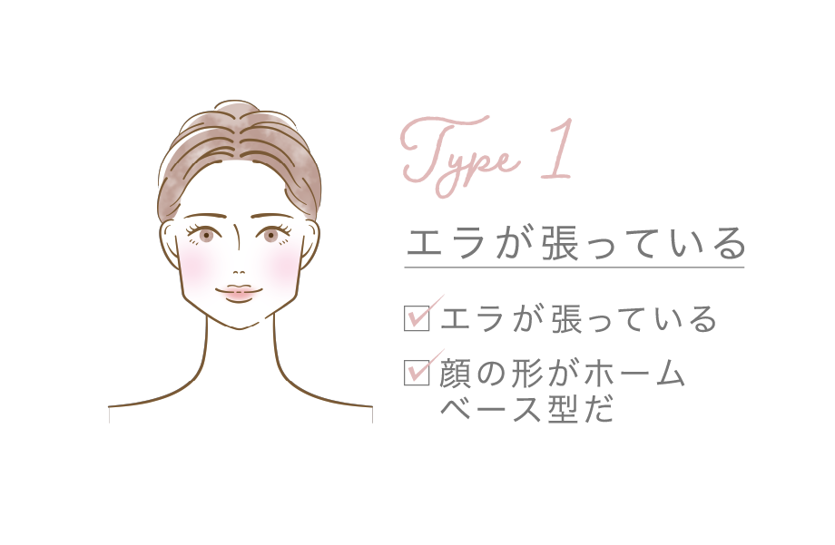 エラが張っている