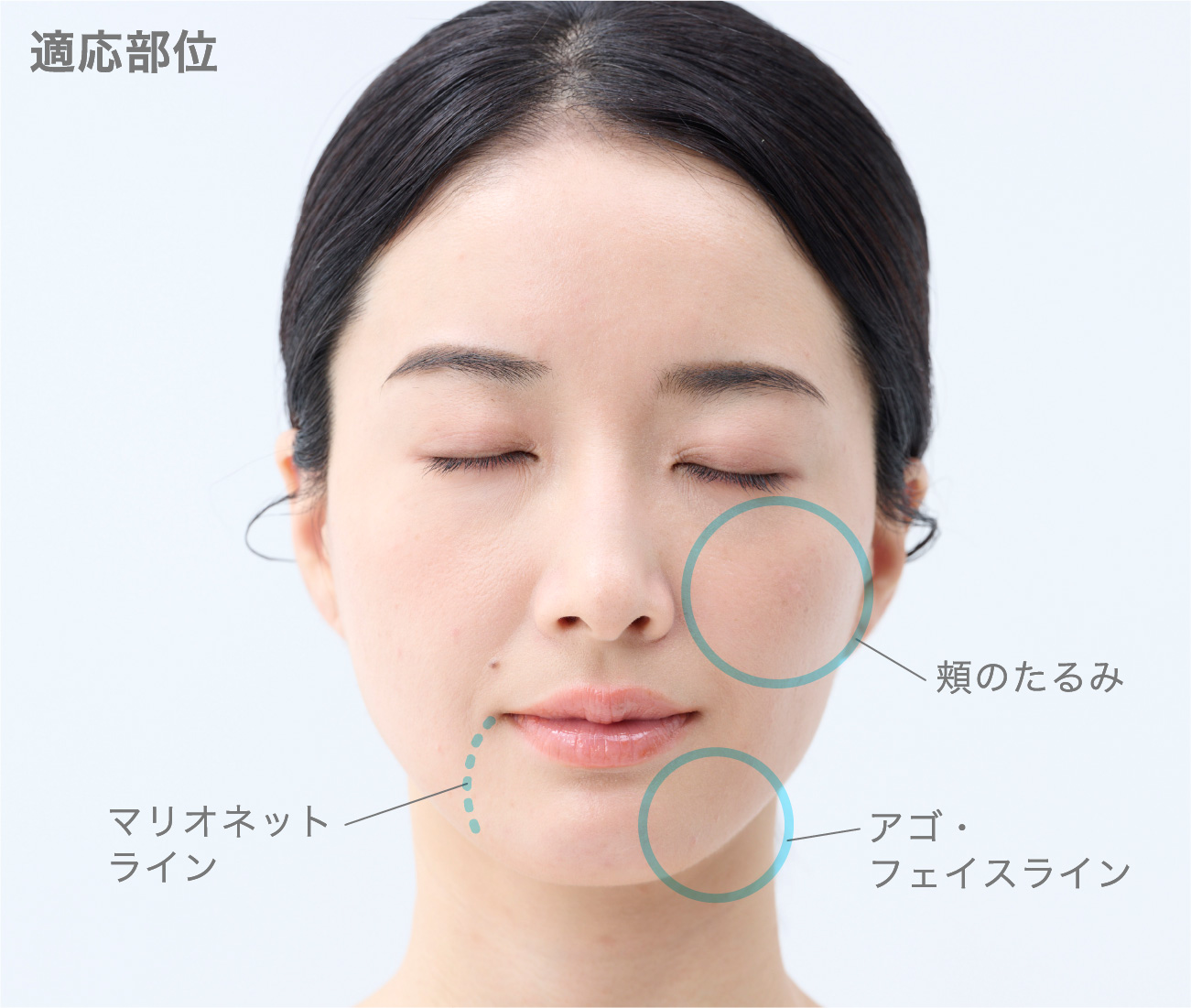 適応部位