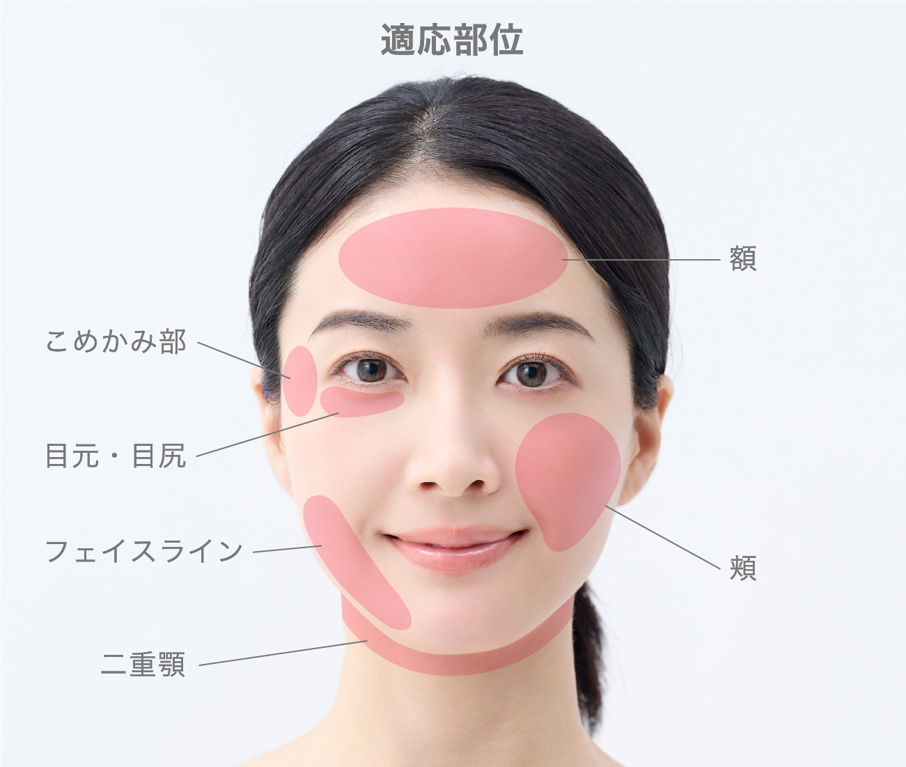 【顔全体のリフトアップ】適応部位