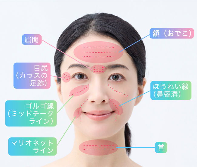 代表的なシワとその名称