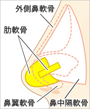 移植