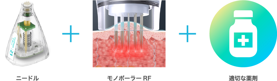 ニードル＋モノポーラーRF＋適切な薬剤
