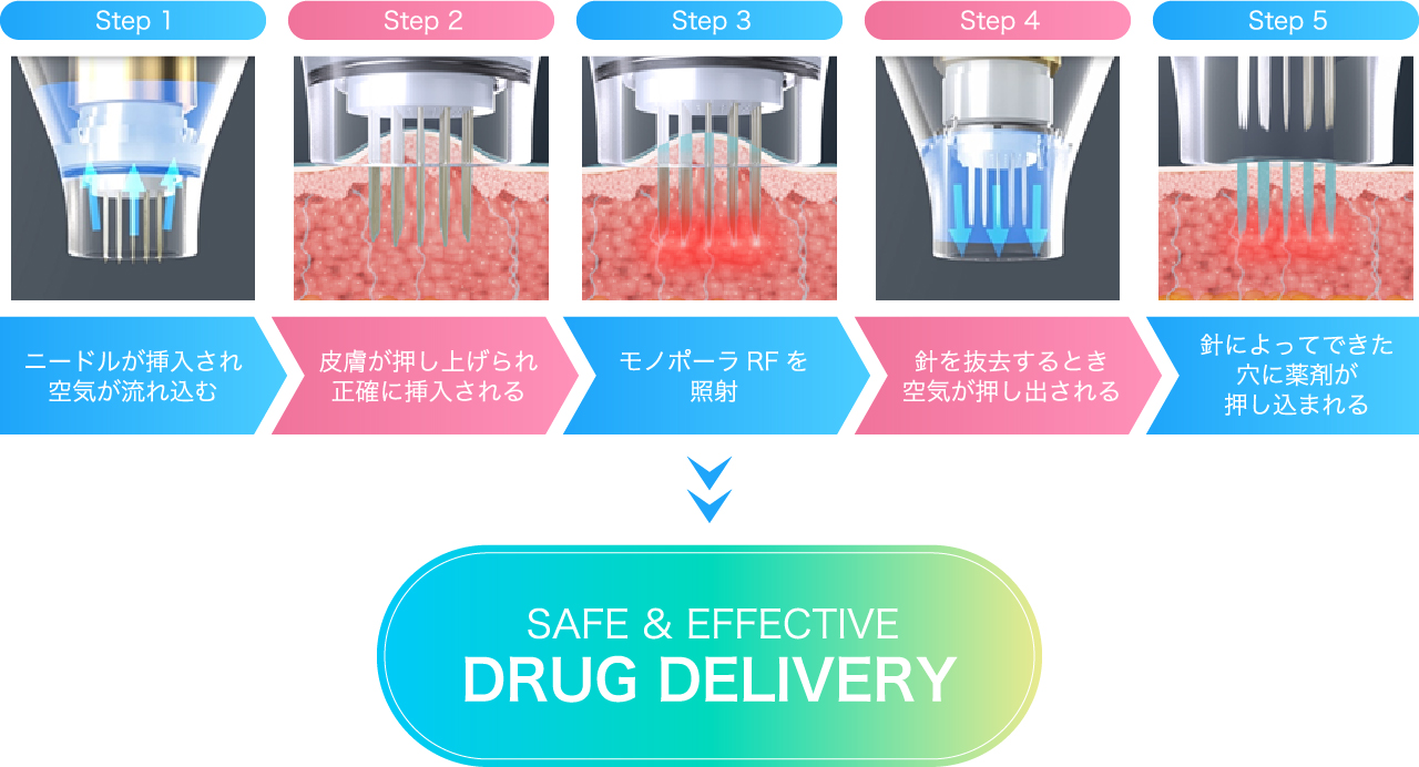 治療メカニズム