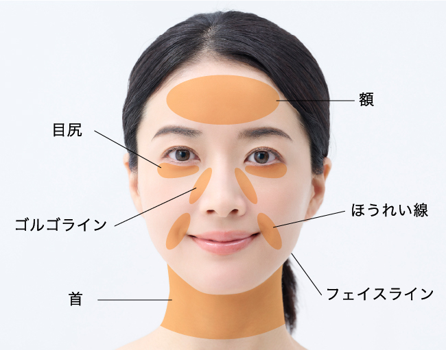 【顔全体のリフトアップ】適応部位
