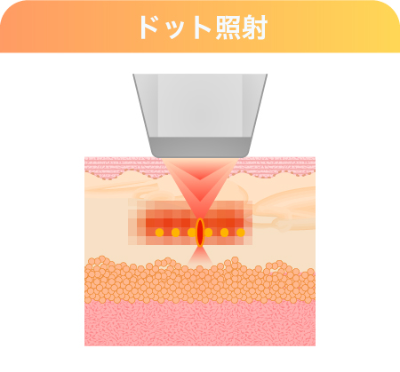 【顔全体のリフトアップ】効果のメカニズム