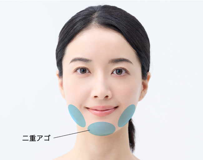 【二重アゴ解消&小顔効果】適応部位