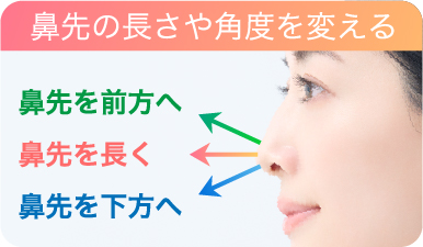 鼻先が整う