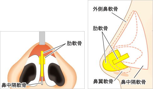 術後の安定感