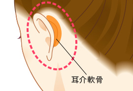 耳介軟骨