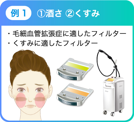 例1