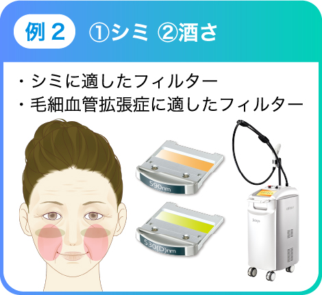 例2