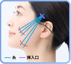 全体的に引き上げたい場合