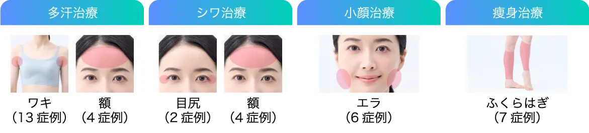 多汗治療 シワ治療 小顔治療 痩身治療