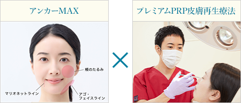 アンカーMAX×プレミアムPRP皮膚再生療法